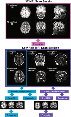 Bridging the gap: improving correspondence between low-field and high-field magnetic resonance images in young people